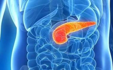 胰腺癌发现便是中晚期，早诊难点在哪里？专家告�诉你真相